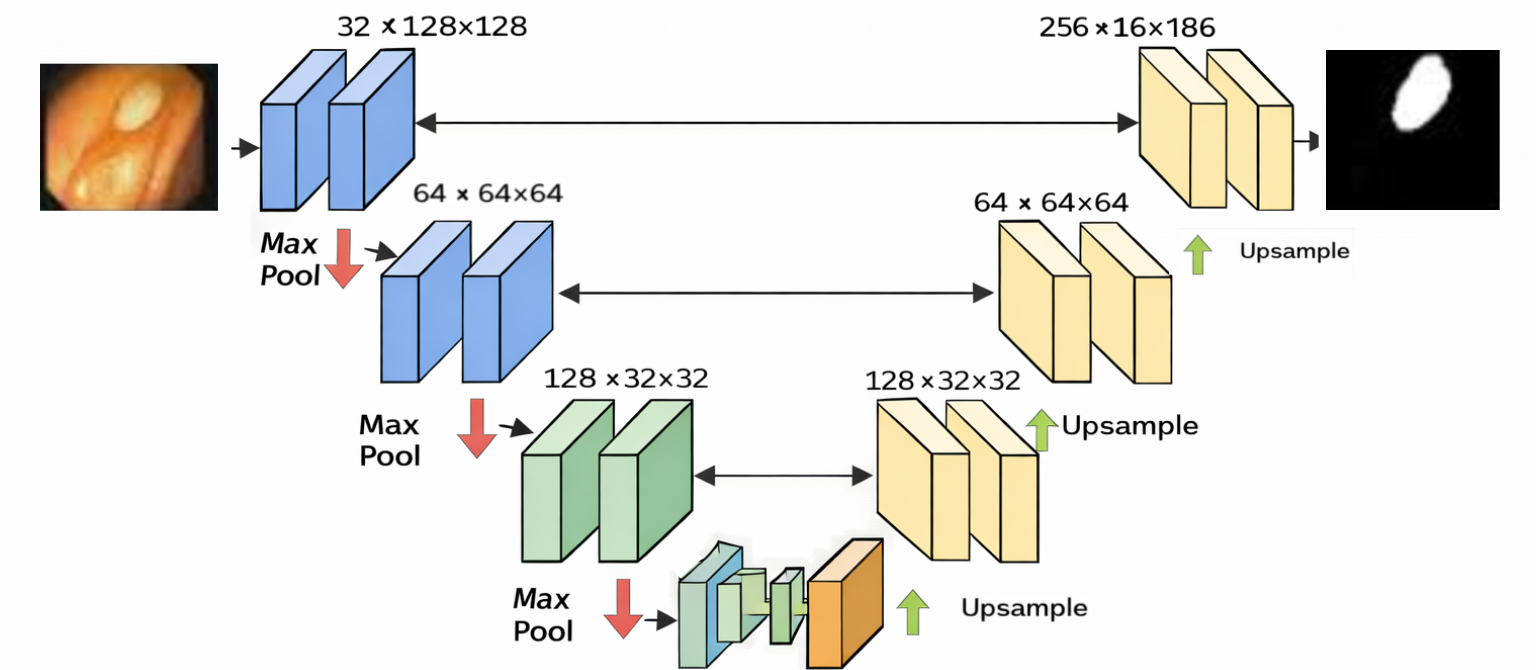 Small U-Net architecture used for polyp segmentation.
